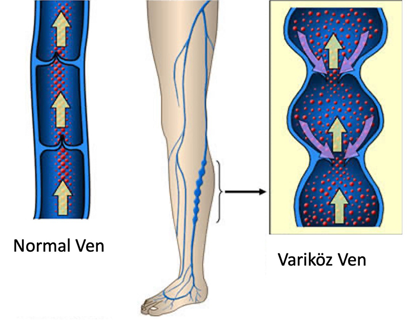 varis_2